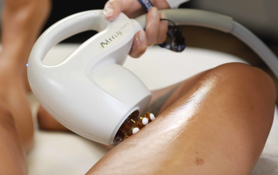 Séance de radiofréquence Unibody : la pièce à main glisse sur la jambe d'une cliente