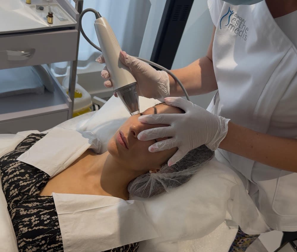 Séance Plasma Glow à la clinique EstheMedis, la praticienne guide la pièce à main sur le visage d'une cliente